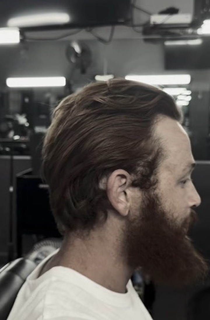 Before right profile
