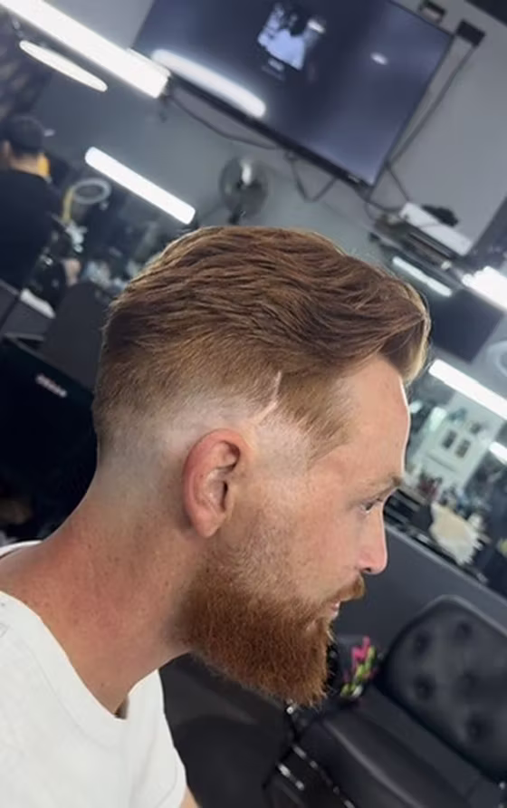 After right profile